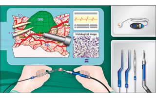 Technische Illustrationen eines OP Arbeitsplatzes der Zukunft für die Fa. Zeiss by Vasco kintzel Grafik-Design
